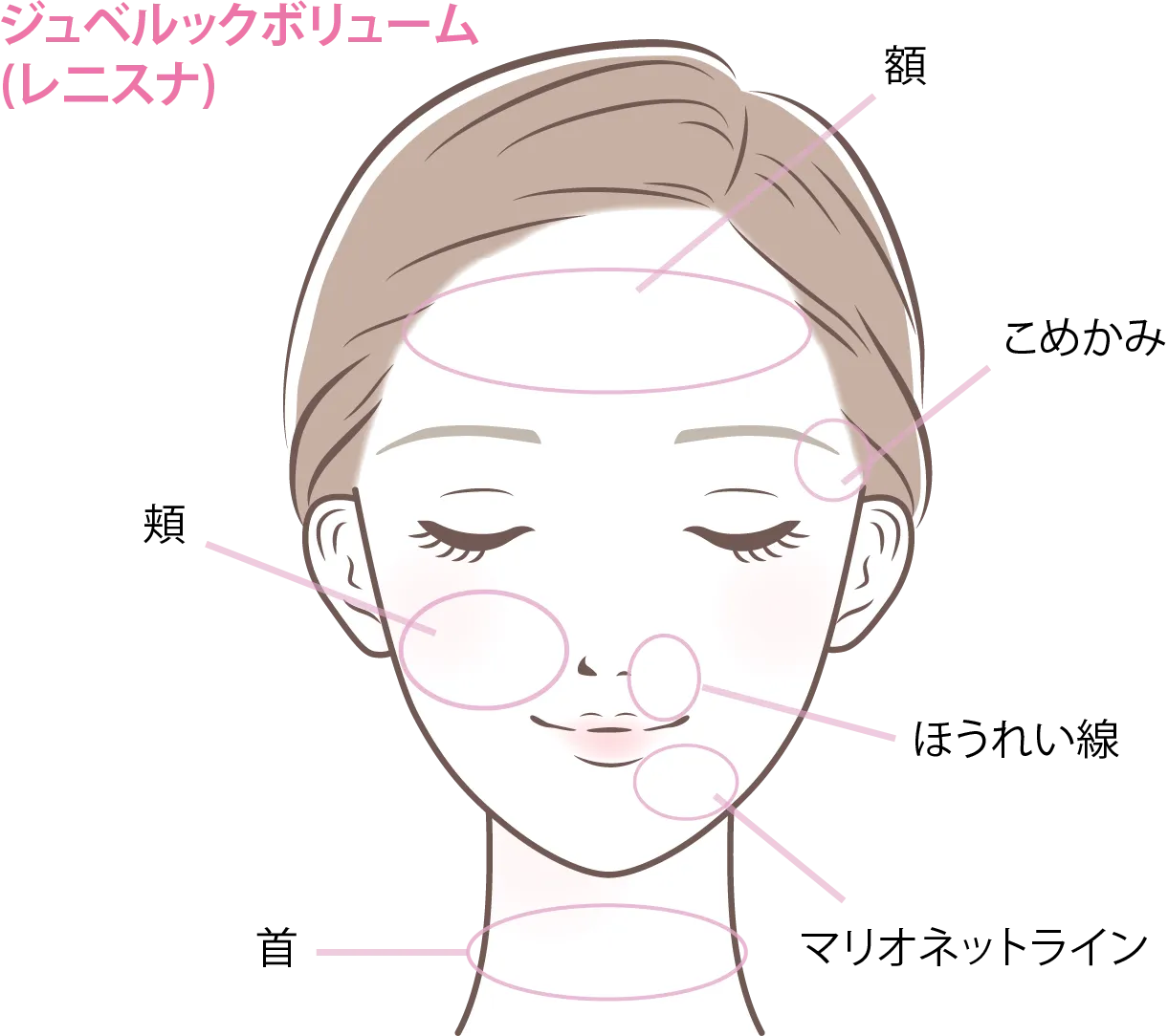 レ二スナの施術箇所